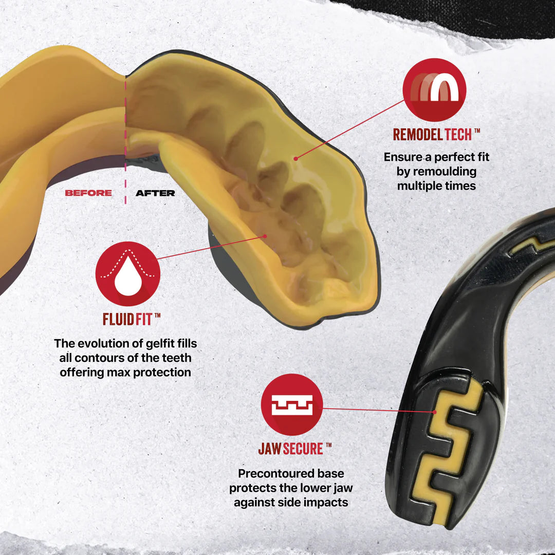 SafeJawz Extro Series Goldie Mouthguard