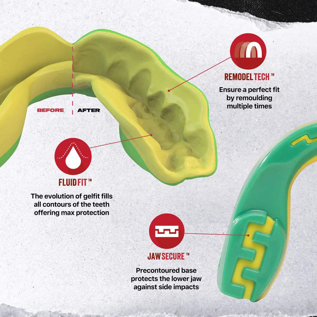 SafeJawz Extro Series Ogre Mouthguard