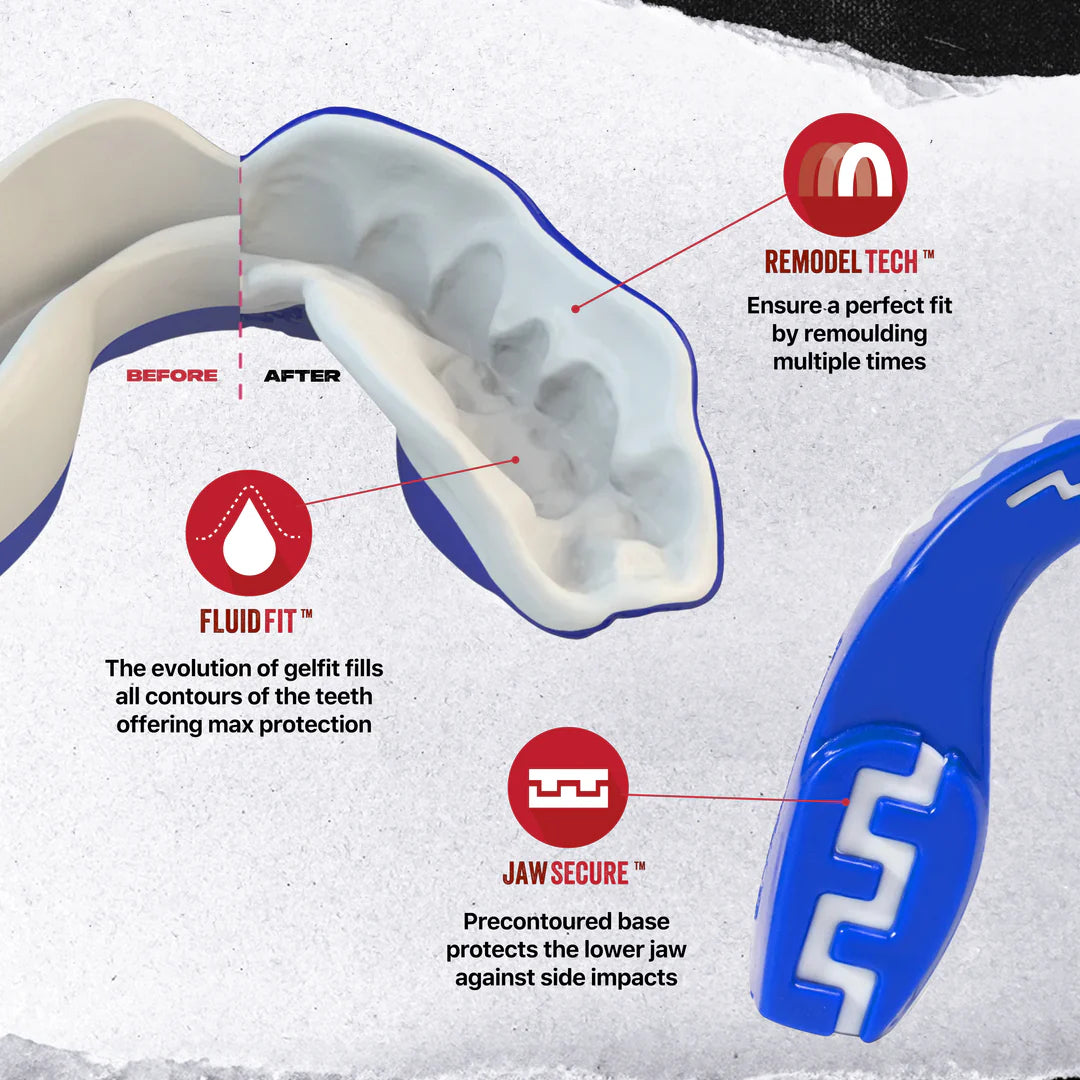 SafeJawz Extro Series Shark Mouthguard