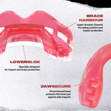 SafeJawz Ortho Series Mouthguard for Braces - Ice Pink