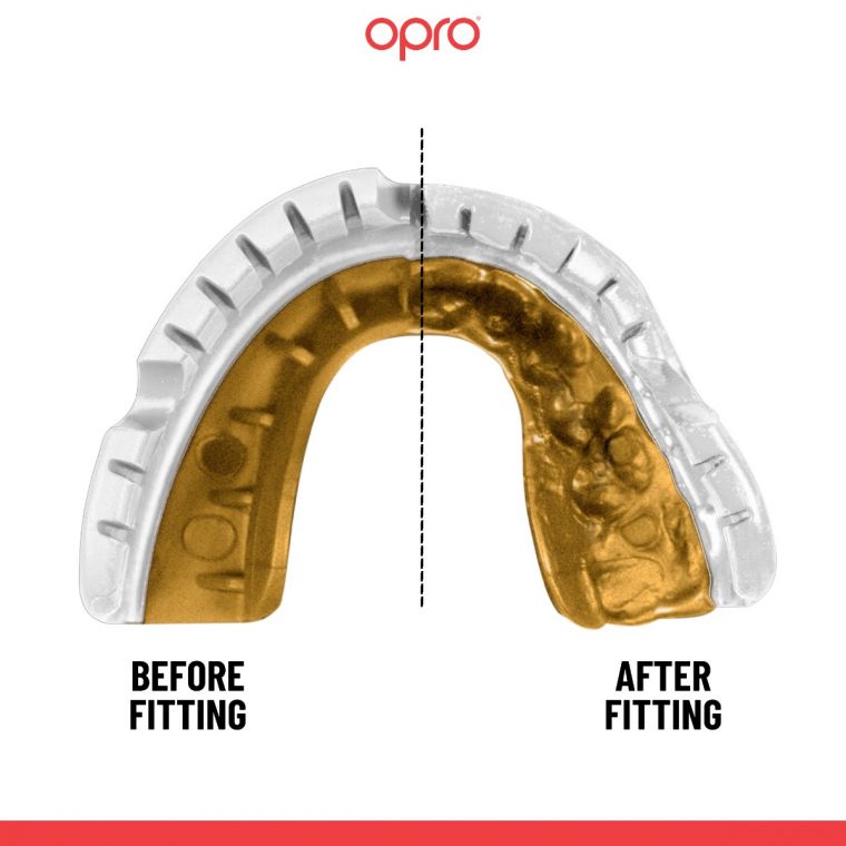 Mouth Guard OPRO GOLD FOR BRACES - white